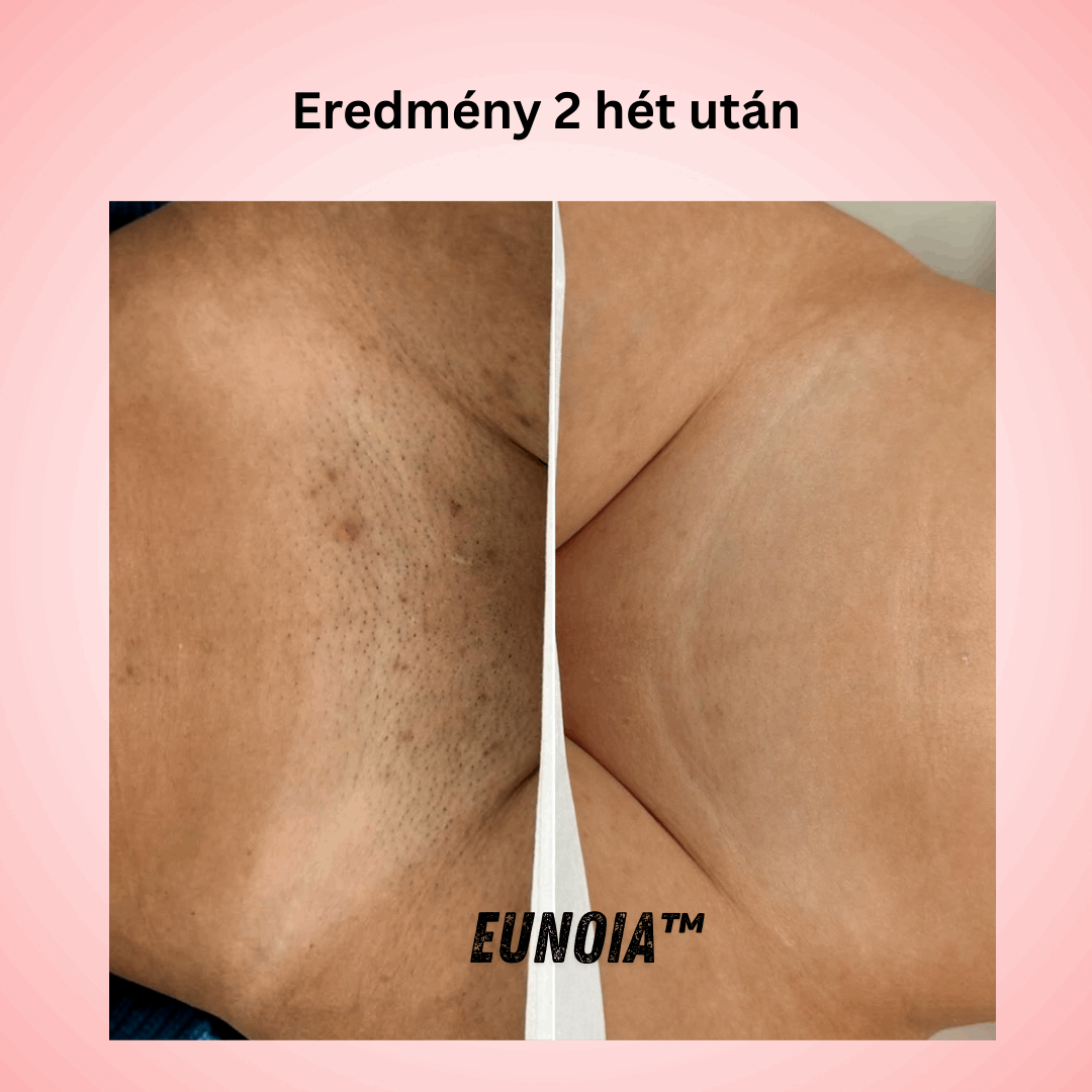 Eunoia™ Gyengéd ápolás az érzékeny területeknek