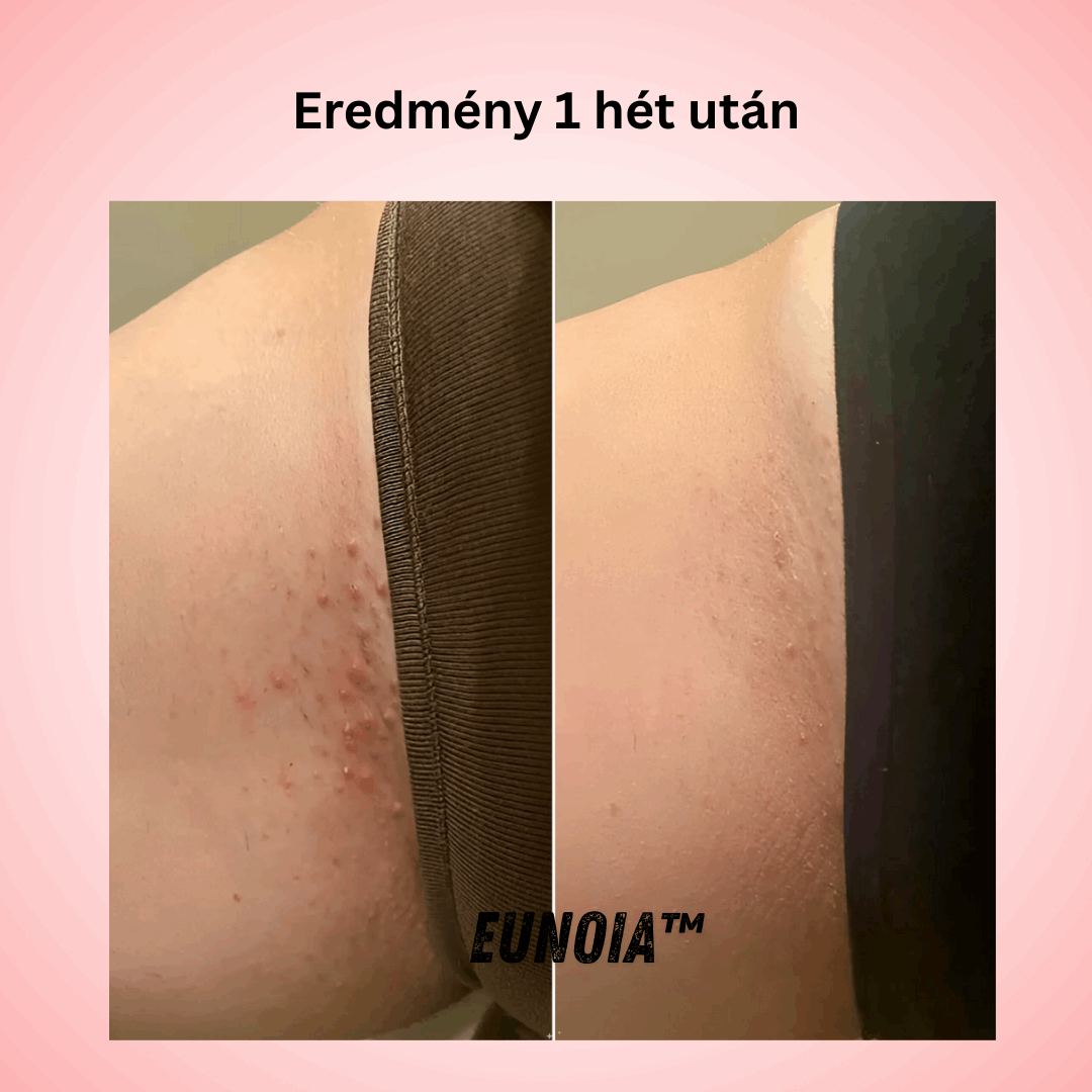 Eunoia™ Gyengéd ápolás az érzékeny területeknek