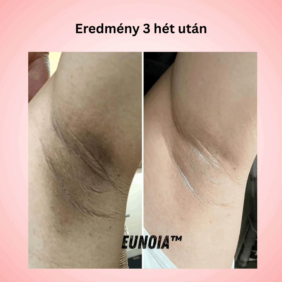 Eunoia™ Gyengéd ápolás az érzékeny területeknek