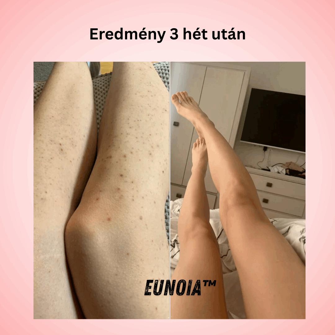 Eunoia™ Gyengéd ápolás az érzékeny területeknek
