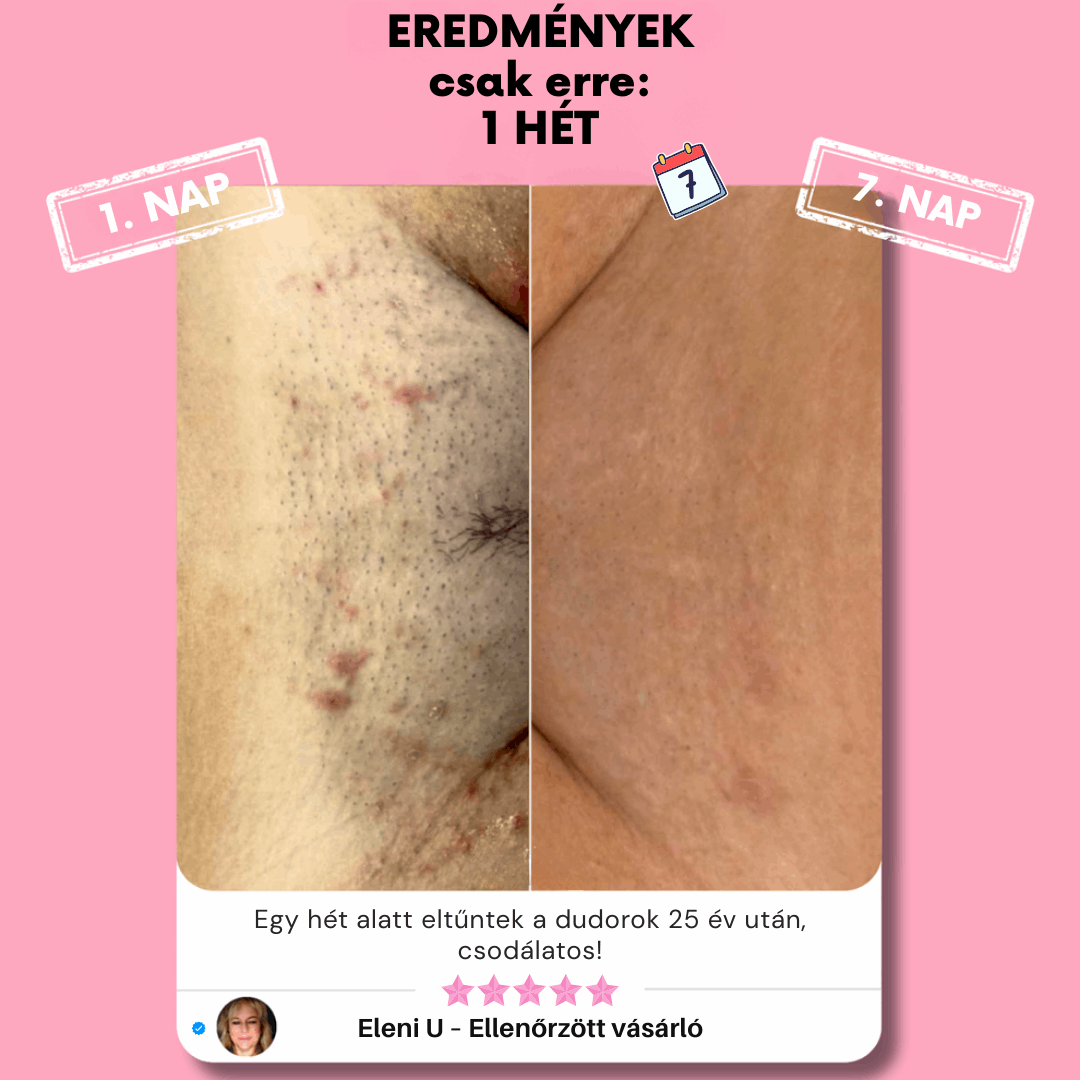 Eunoia™ Gyengéd ápolás az érzékeny területeknek