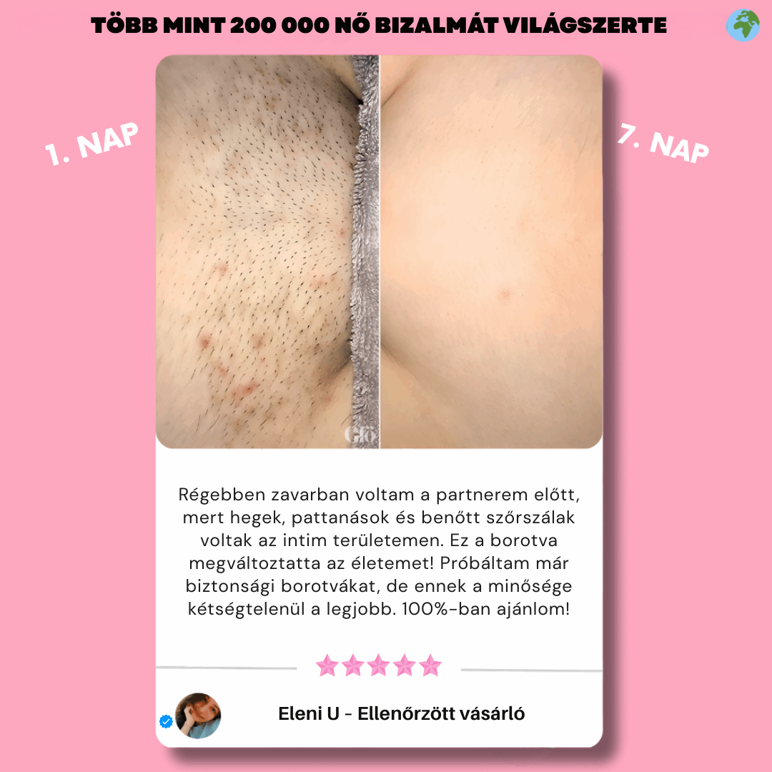 Eunoia™ Gyengéd ápolás az érzékeny területeknek