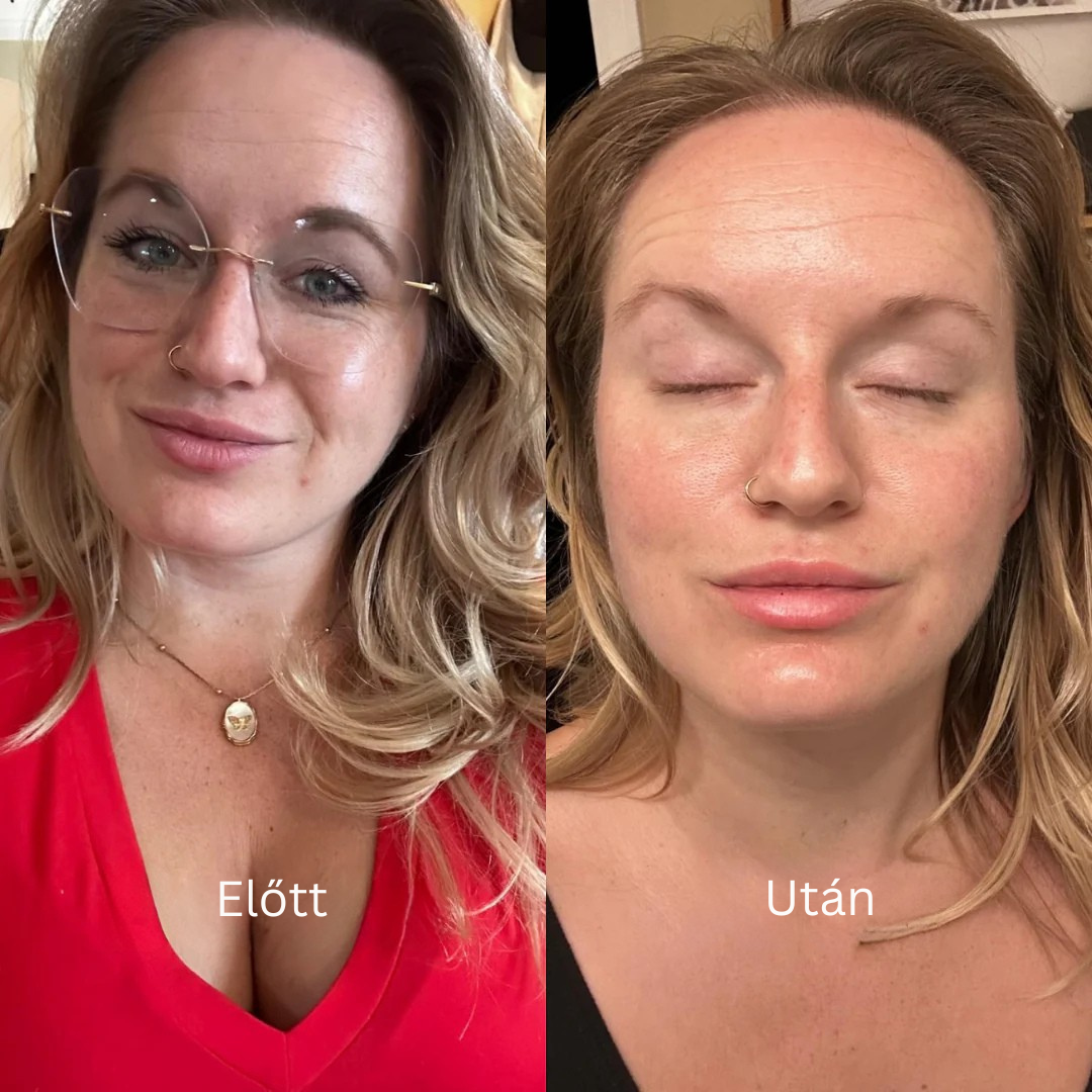 Collagen
